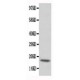 cardiac Troponin C Antibody