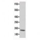 cardiac Troponin C Antibody