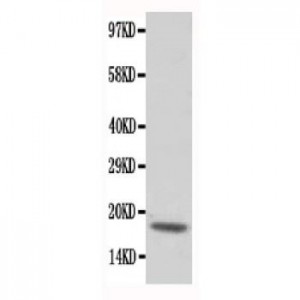 cardiac Troponin C Antibody