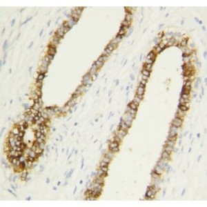 Caspase-1(P10) Antibody