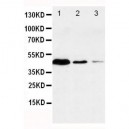 Caspase-1(P20) Antibody