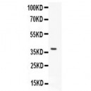 Caspase-3  Antibody