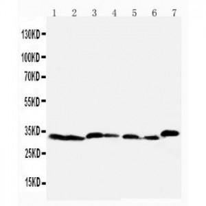 Caspase-6(P18) Antibody