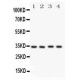 Caspase-7(P11) Antibody