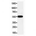 Caspase-8(P10) Antibody