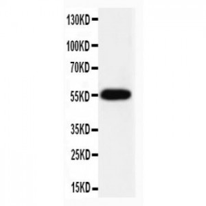 Caspase-8(P10) Antibody