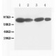 Catenin gamma(Plakoglobin) Antibody (monoclonal)