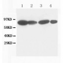 Catenin gamma(Plakoglobin) Antibody (monoclonal)