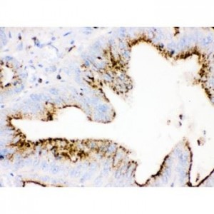 Cathepsin D Antibody (monoclonal)