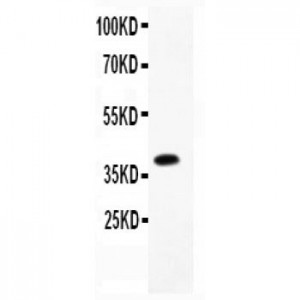 Caveolin-1  Antibody