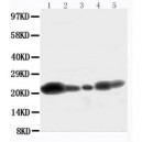 Caveolin-1 Antibody