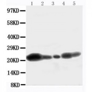 Caveolin-1 Antibody