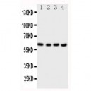 CBS Antibody