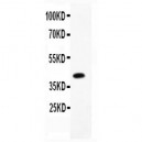 CBS Antibody