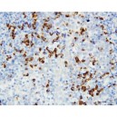 CCR4 Antibody