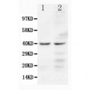 CCR5 Antibody