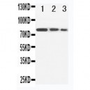 CD105 Antibody