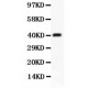 CD3 epsilon  Antibody