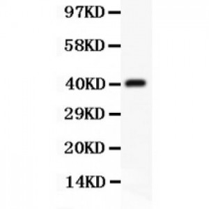 CD3 epsilon  Antibody