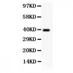 CD31  Antibody