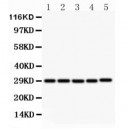 CD40L Antibody