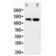 CD62E Antibody