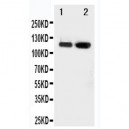 CD62E Antibody