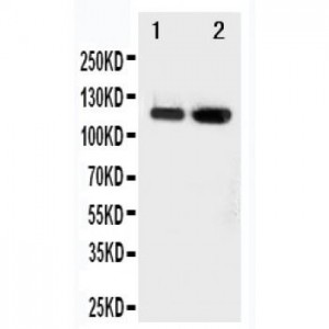 CD62E Antibody