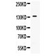 CD62P Antibody