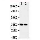 CD68 Antibody