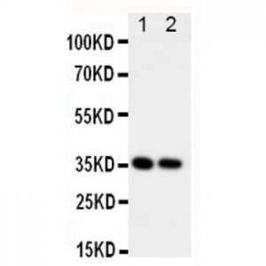 CD68 Antibody