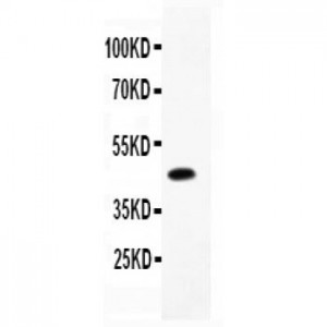 CD79a  Antibody