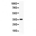 CD82  Antibody