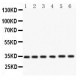 Cdk4  Antibody