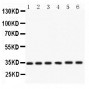 Cdk4  Antibody