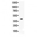 Cdk9  Antibody