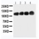 CEA Antibody (monoclonal)