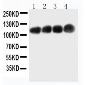 CEA Antibody (monoclonal)