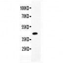 CEBP Beta  Antibody