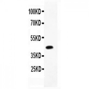 CEBP Beta  Antibody