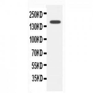 CFTR Antibody