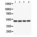 Chromogranin A  Antibody