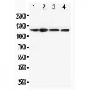 CIAS1/NALP3 Antibody