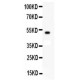 c-Kit  Antibody