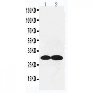 Collagen IV Antibody