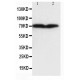 Collagen, Type III Antibody (monoclonal)