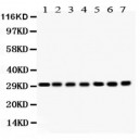 COMT  Antibody