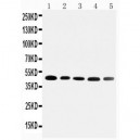 Cortisol Binding Globulin Antibody