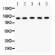 CPT1B  Antibody