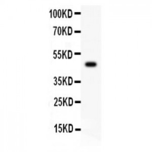 CSK  Antibody